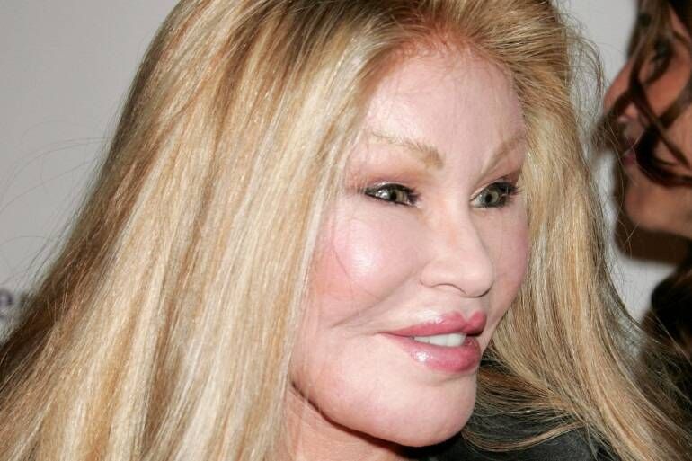 Décès à Paris de la "femme-chat" Jocelyn Wildenstein, figure de la jet-set connue pour ses nombreuses opérations de chirurgie esthétique