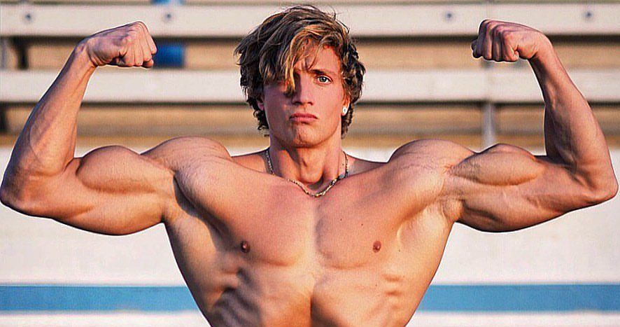 Bodybuilder ‘Joesthetics’ Jo Lindner died of Aneurysm: Meaning, symptoms, treatment, diagnosis