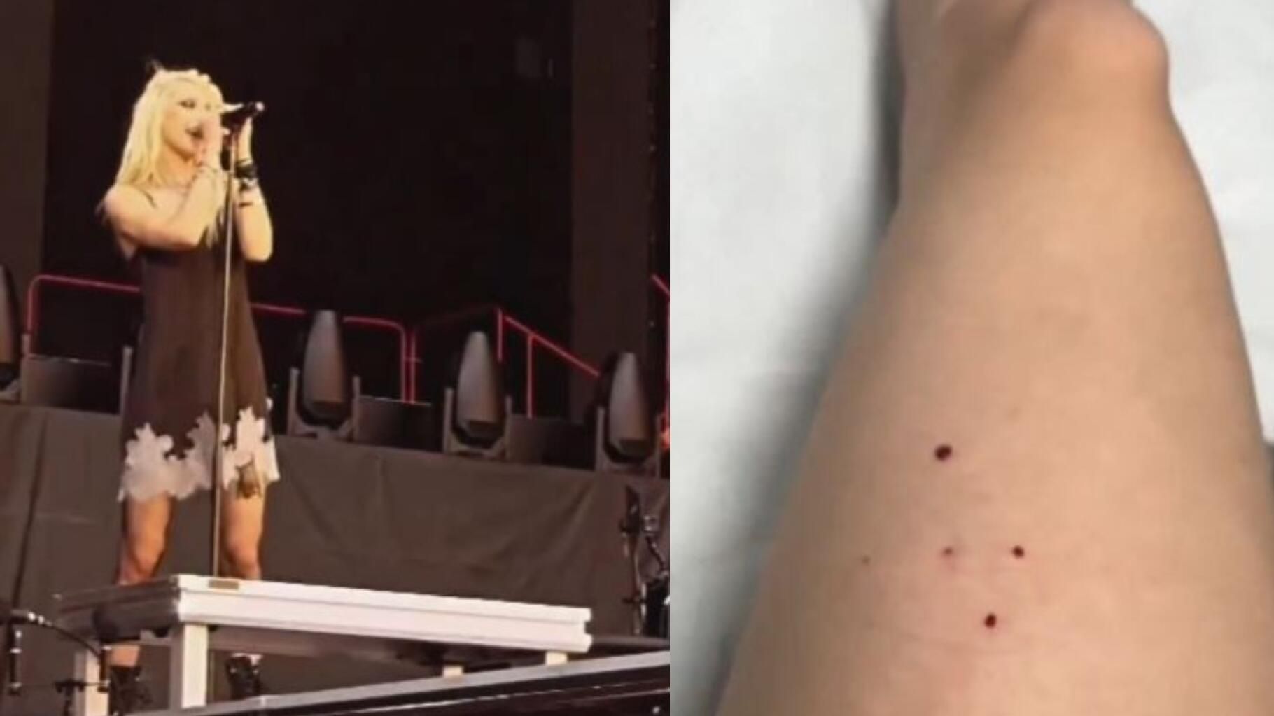 En plein concert, une chauve-souris se pose sur la jambe de Taylor Momsen… et la mord