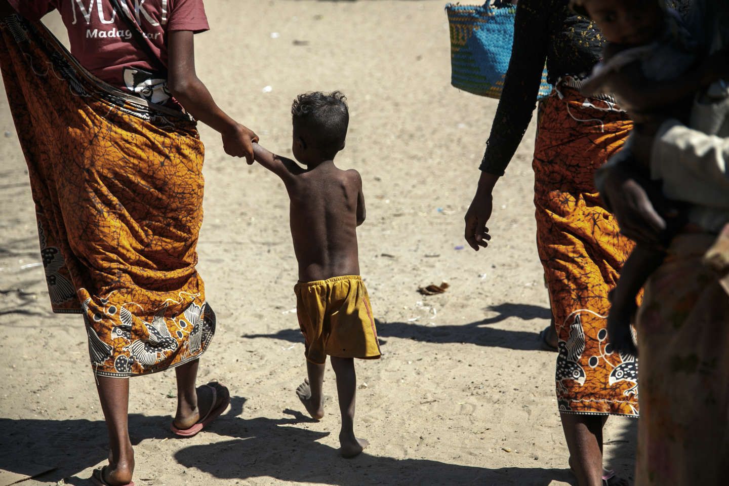 L’ONU alerte sur la gravité record des crises alimentaires dans le monde