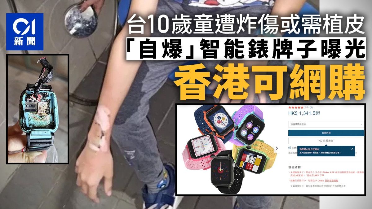 Hero Watch智能手錶爆炸自燃 台10歲童炸傷或需植皮 香港可網購