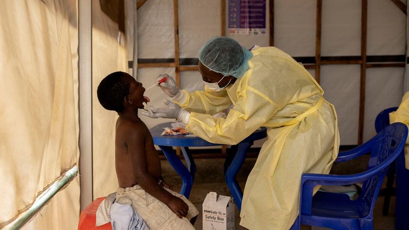 Deadlier strain of mpox spreads to more countries, raising officials’ alarm