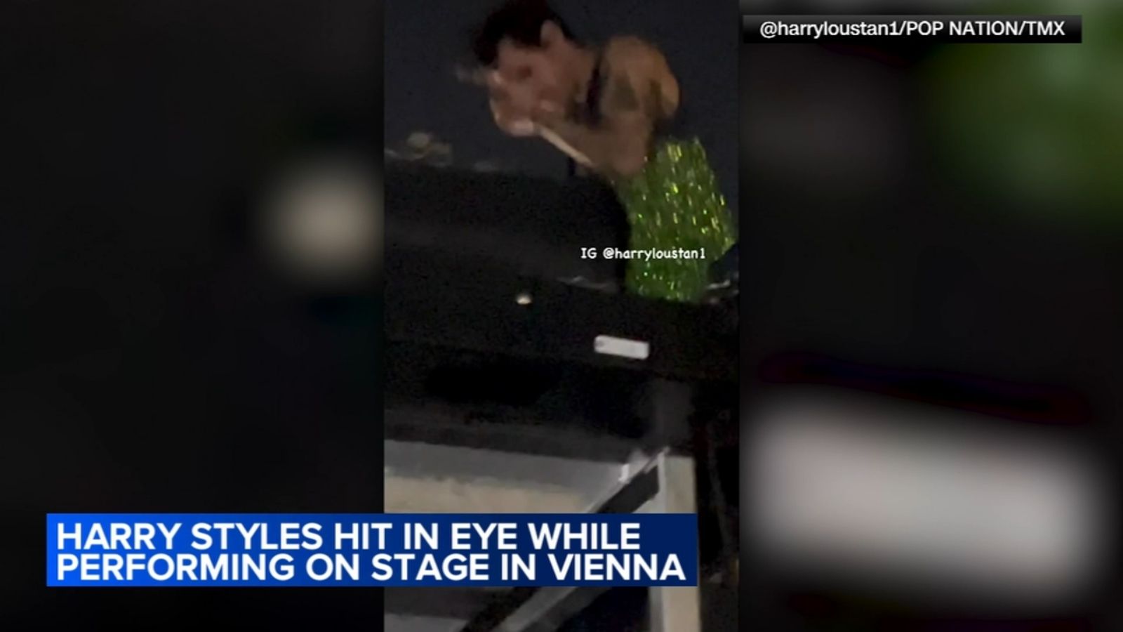 Harry Styles hit in eye with object while performing on stage at Vienna concert