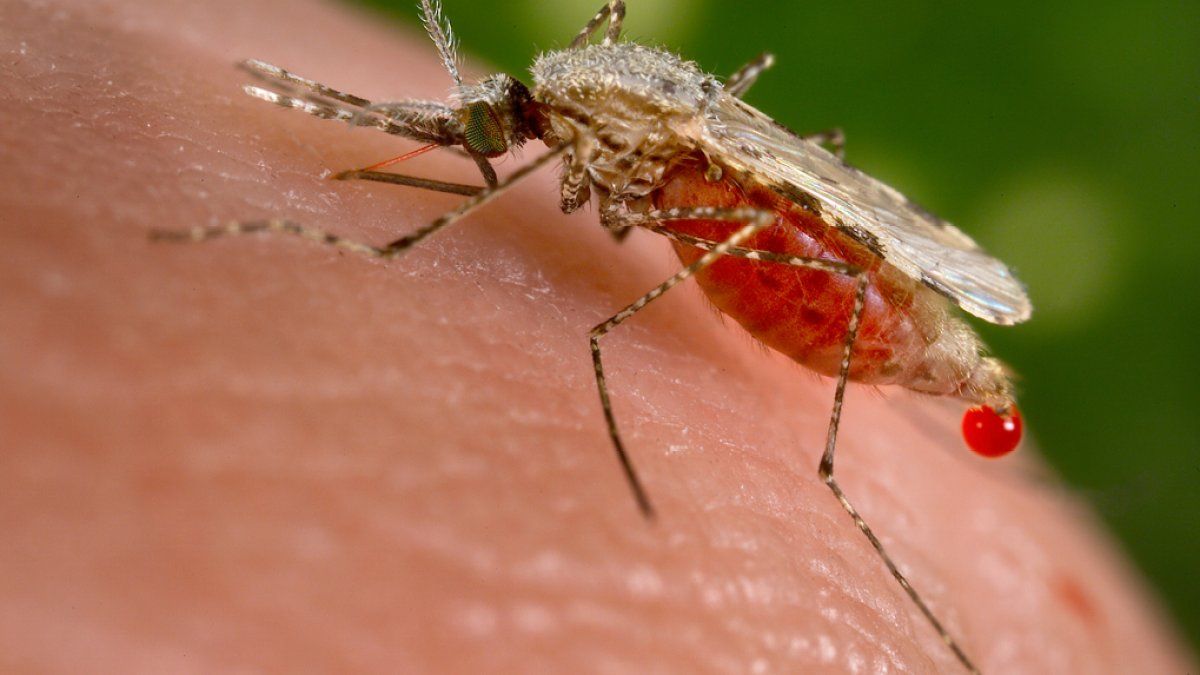 As malaria cases tick up in Florida, a doctor treating patients describes their symptoms