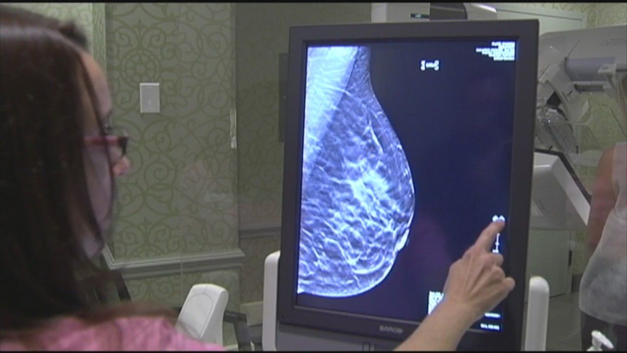 Iowa doctor stands firm on mammogram recommendations despite possible changes