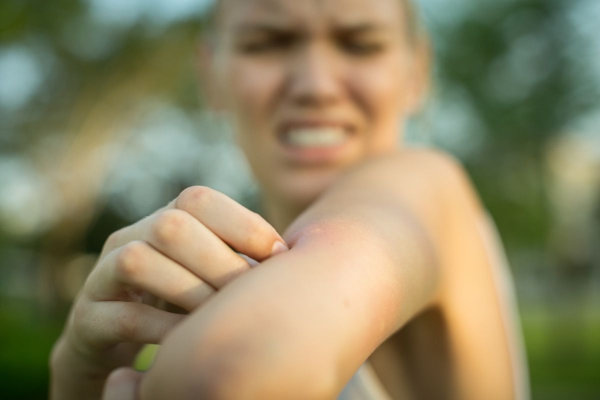 Soaps and Scents That Repel Mosquitoes