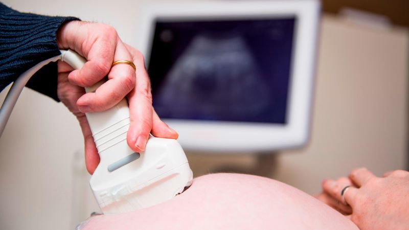 Millions of people have long Covid, including children and pregnant people, studies show