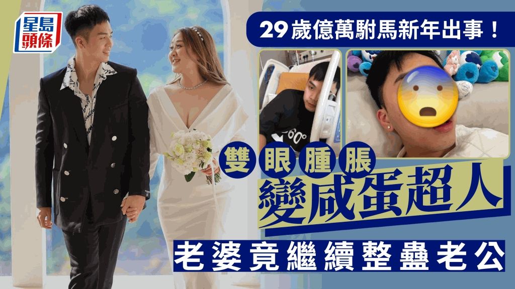 29歲「億萬駙馬」雙眼腫脹變咸蛋超人！老婆有一要求 無奈開年：有冇良心呀你