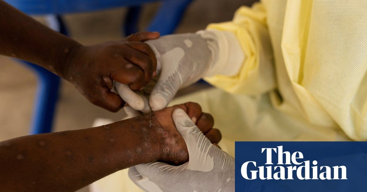 Africa CDC declares mpox outbreak a public health emergency