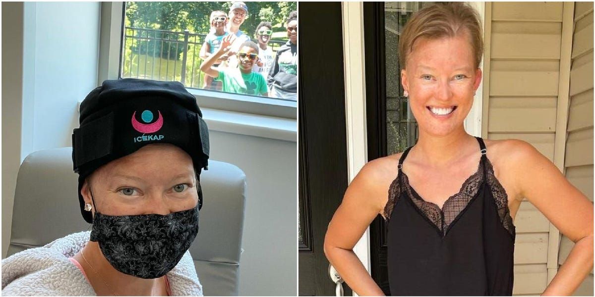 I Did Not Wear a Wig After Getting Chemo for My Breast Cancer