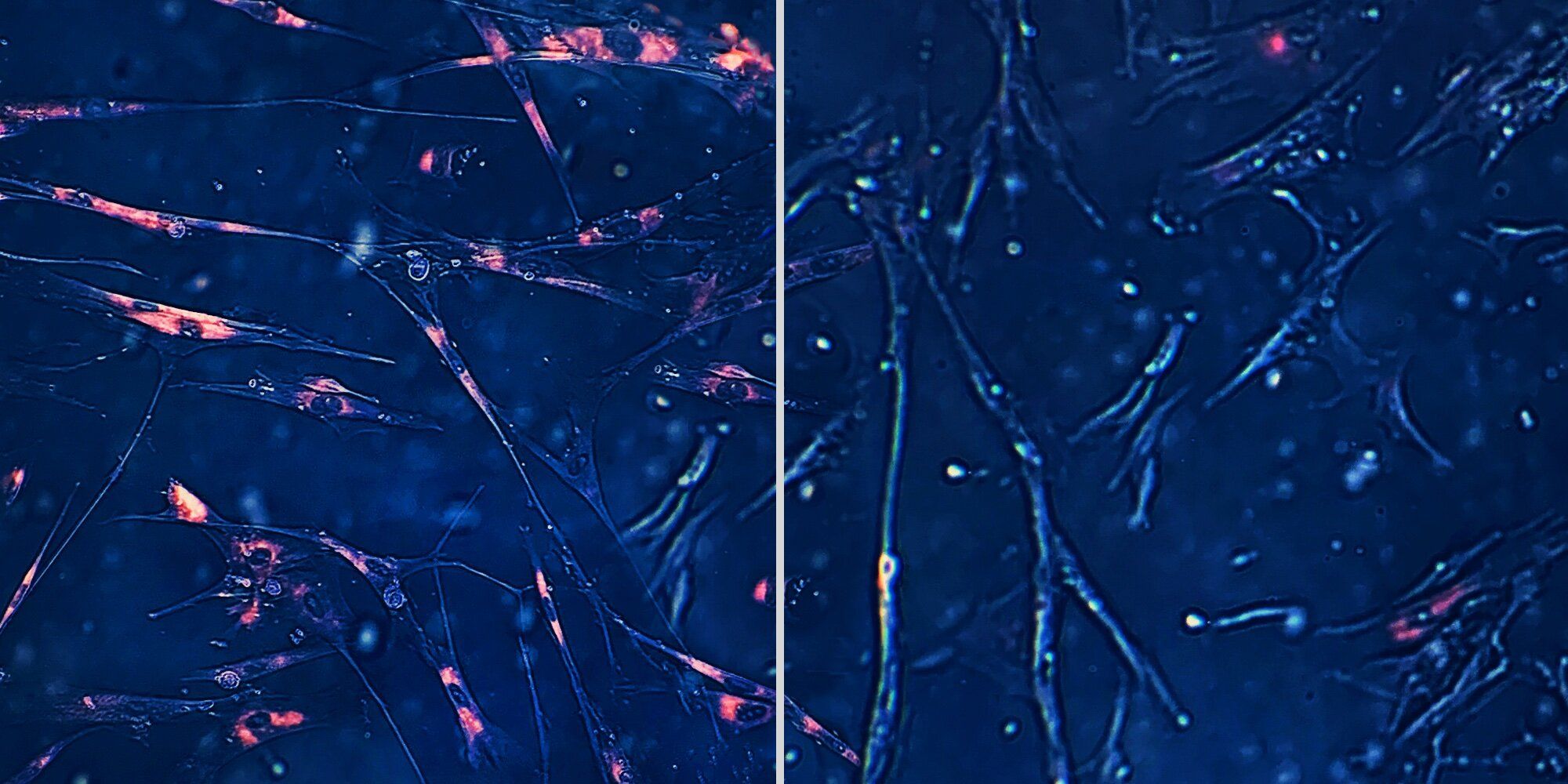 Une Intelligence Artificielle révèle trois molécules antivieillissement jusqu'alors inconnues