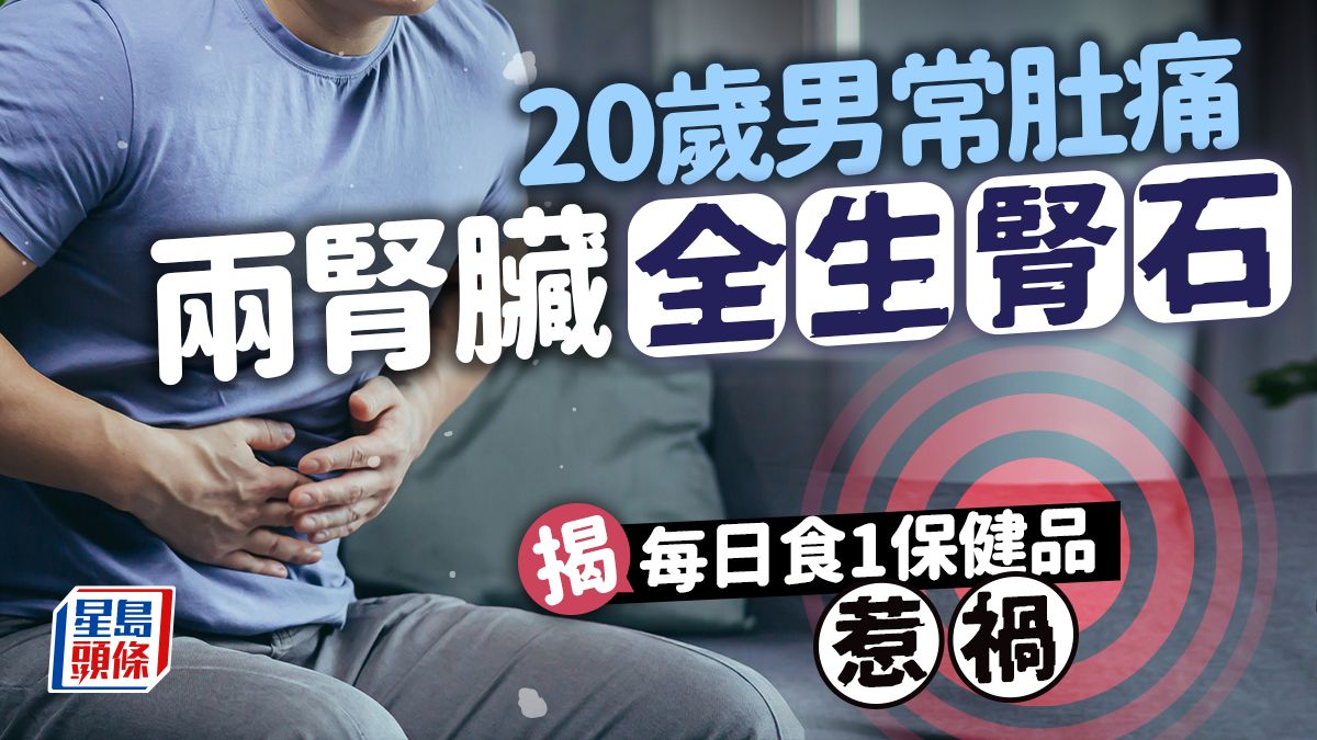 腎石成因｜20歲男肚痛兩腎臟全生腎石 揭每日吃1種維他命惹禍