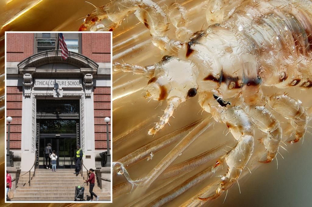 Lice outbreak at Manhattan’s famed Fieldston School