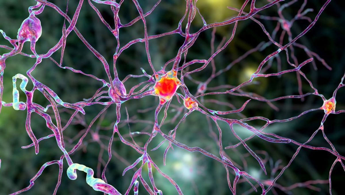 Just One Protein Is All That's Needed To Spark Huntington's Disease