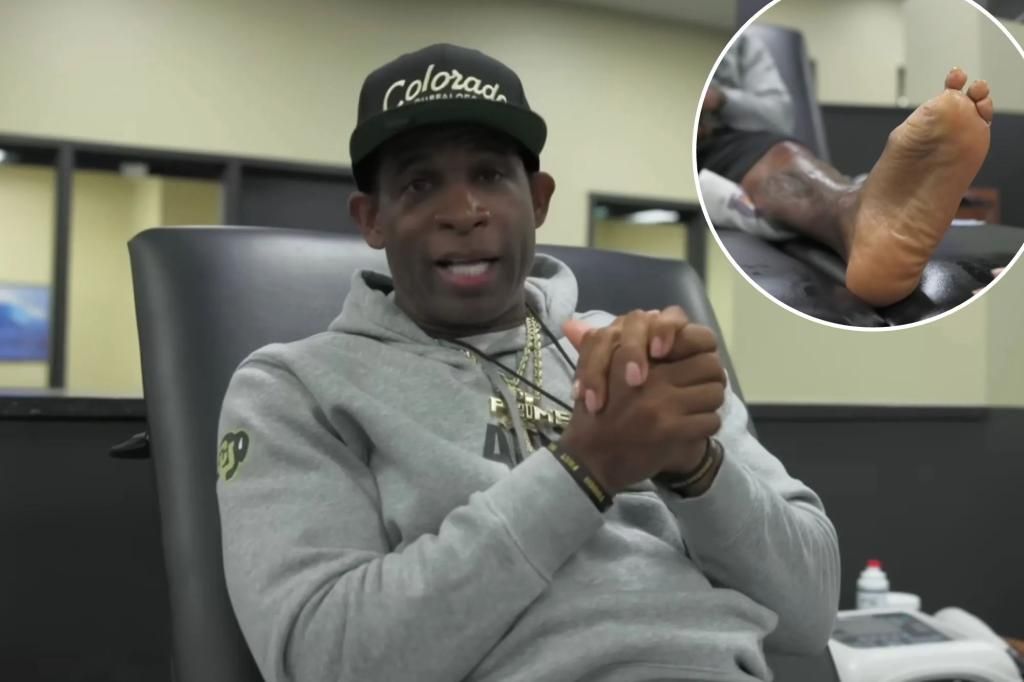 NFL legend Deion Sanders to have more surgeries on foot, leg