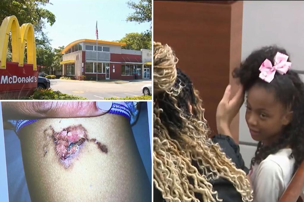 Florida jury awards 8-year-old girl $800K after she got 2nd-degree burns from a McDonald's chicken nugget