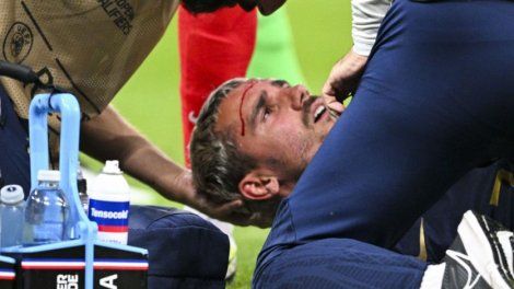 Bleus : L'épaule lacérée de Griezmann