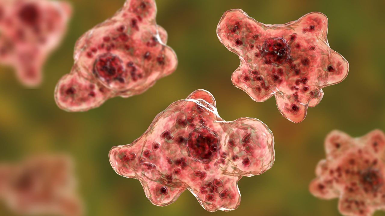 2-year-old boy dies from brain-eating amoeba in Las Vegas