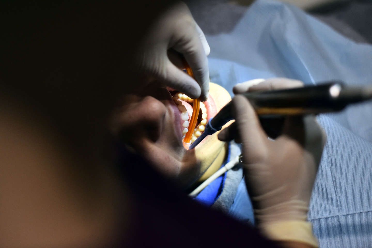 Déserts médicaux : vers une régulation de l’installation pour les chirurgiens-dentistes