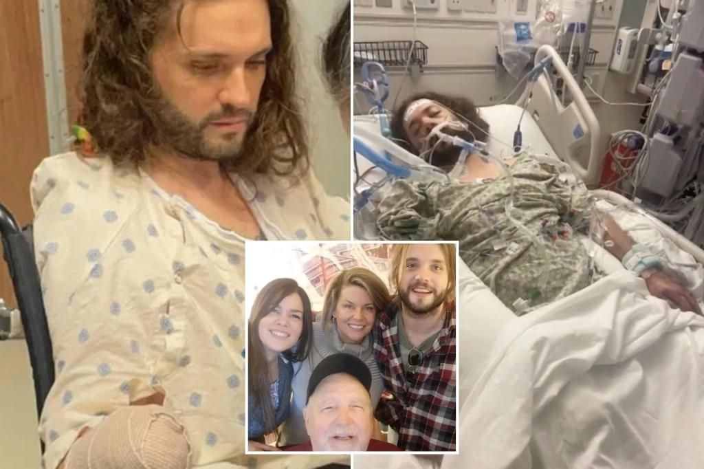 Texas man loses both arms, part of his feet after a single flea bite