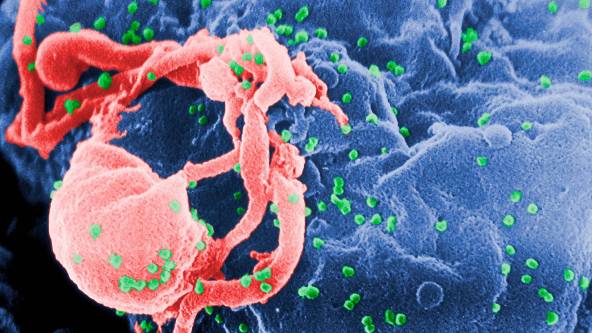 HIV infections decline but most at-risk people don't get PrEP