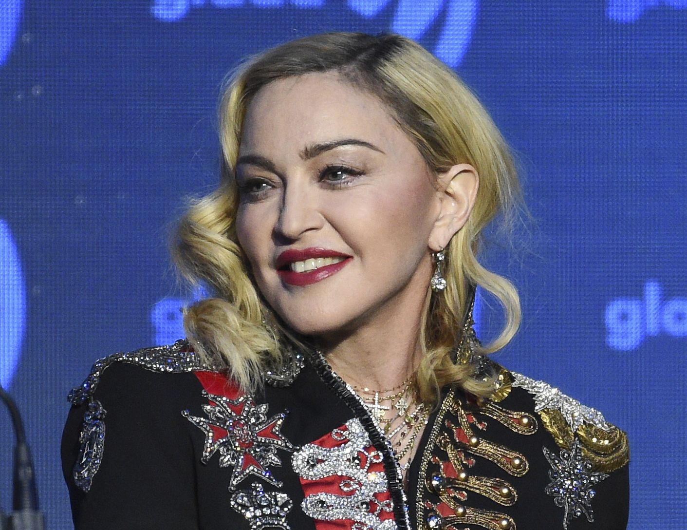 Madonna says it’s a ‘miracle’ she’s alive ahead of Bay Area concerts.