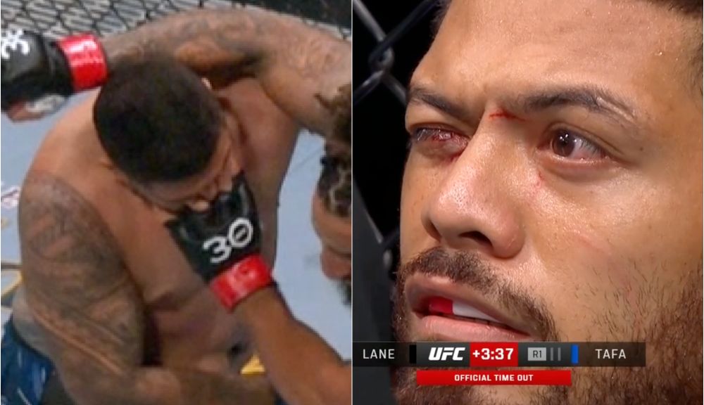 Worst eye poke in UFC history? Austen Lane vs Justin Tafa ends grossly