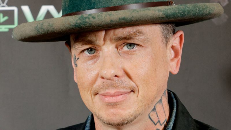 Slipknot bandmember Sid Wilson has ‘sustained burns across his body’ in an accident