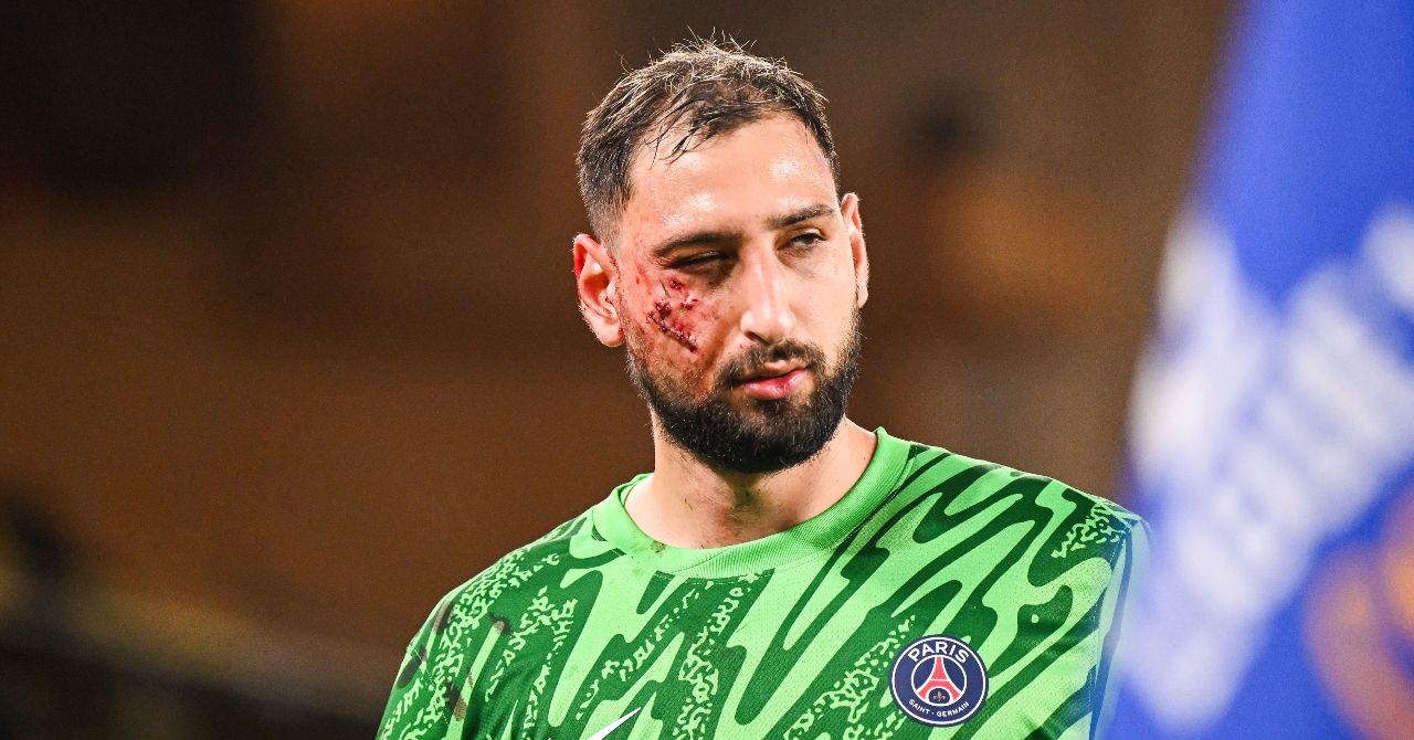 Donnarumma dans un sale état