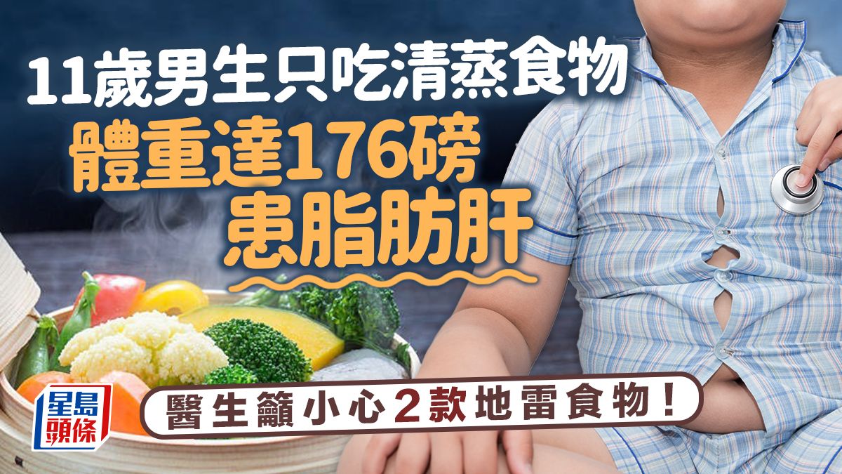 脂肪肝飲食｜11歲男生只吃清蒸食物也患脂肪肝 體重達176磅揭2款食物惹禍