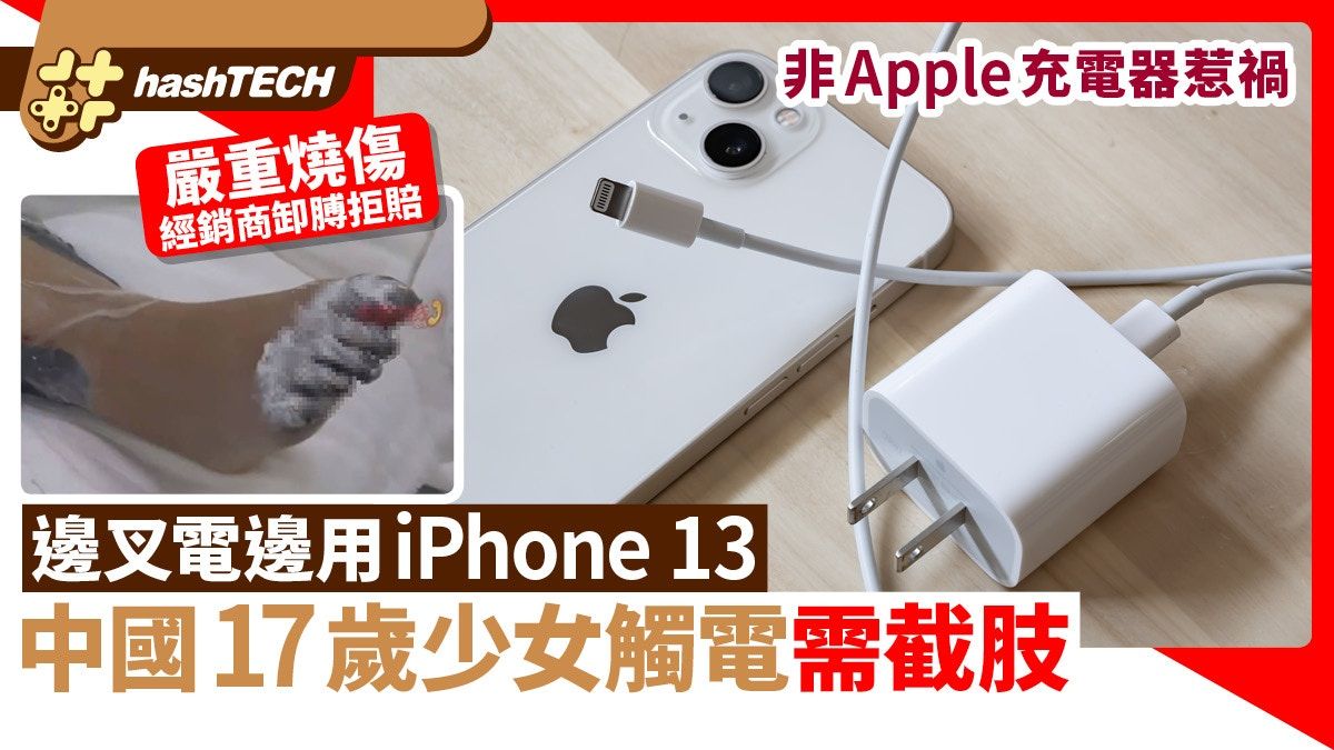 邊叉電邊用iPhone 13 17歲少女觸電須截肢｜用非Apple充電器惹禍