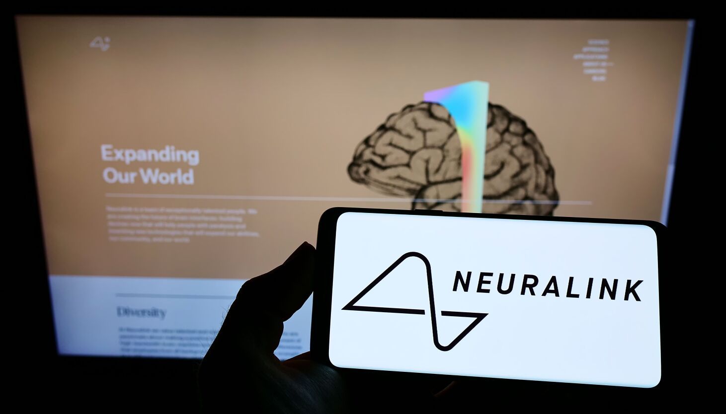 Elon Musk’s Neuralink gets FDA signoff on human brain implant trials