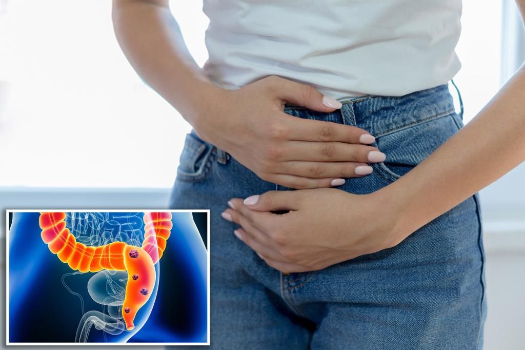 Colorectal cancer rise in young may be from fungus