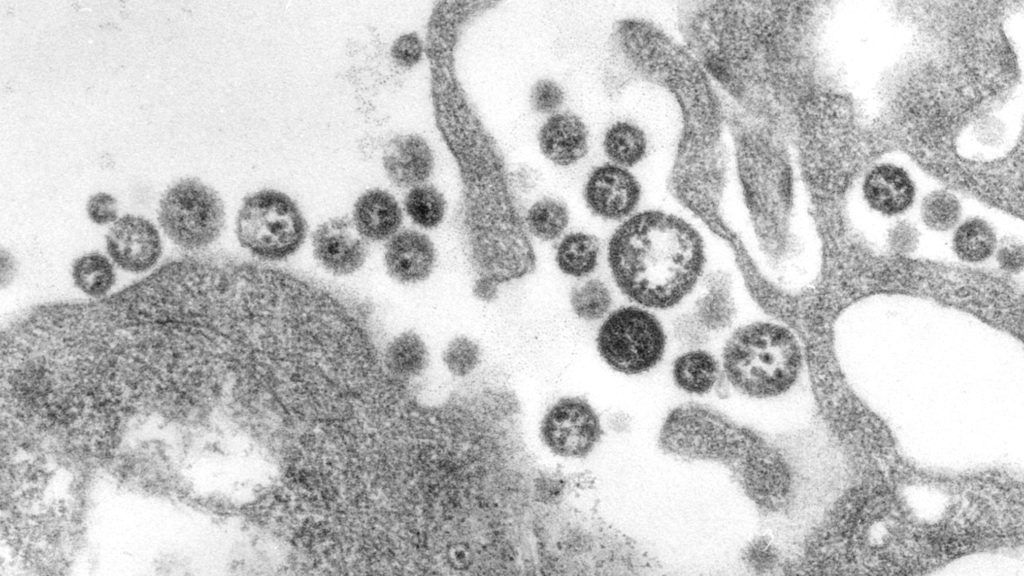 U.S. death from Lassa fever, an Ebola-like virus, is reported in Iowa