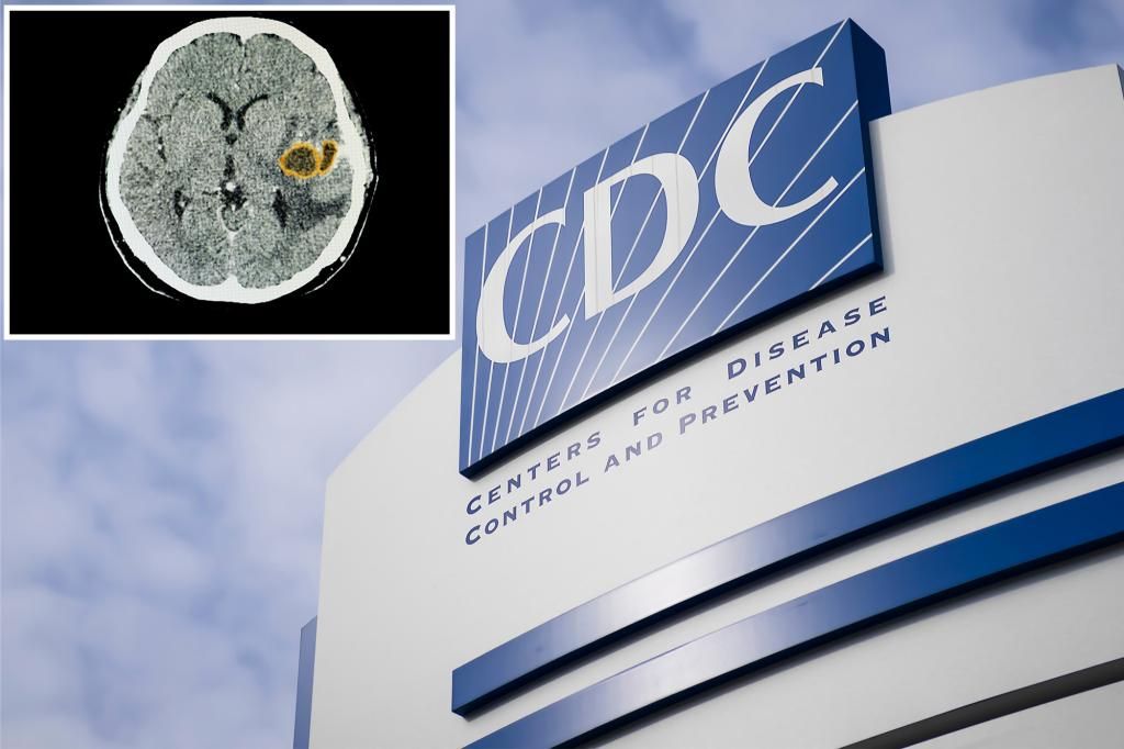 Doctors concerned over spiking brain infections in kids