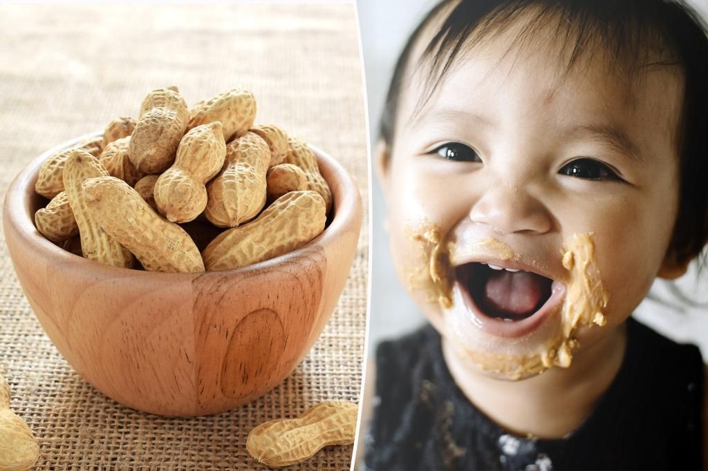 Introducing peanuts early reduces kids' allergy risk: study