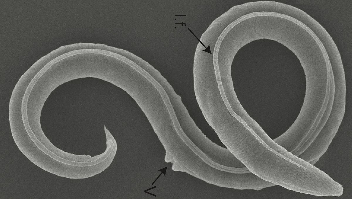 46,000-Year-Old Worms Revived After Millennia Frozen In Siberian Permafrost