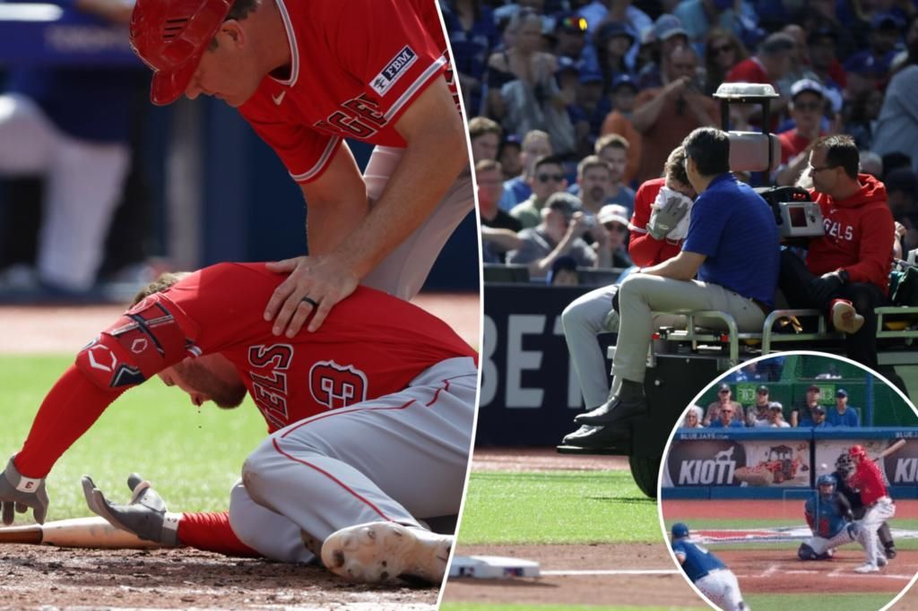 Angels' Taylor Ward bloodied, carted off after taking pitch to face