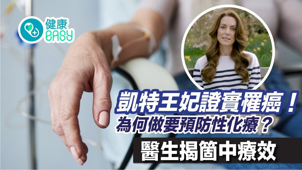 英國王室｜凱特王妃證實罹癌！為何做預防性化療？醫揭箇中療效