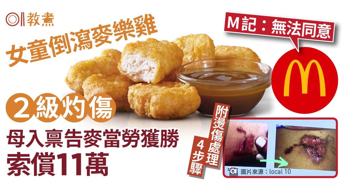 麥當勞灼傷｜女童倒瀉麥樂雞2級燒傷 母索償11萬！附灼傷處理法